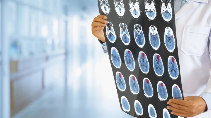 doctor holding images of brain
